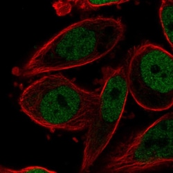Invitrogen AP2 gamma Polyclonal Antibody 100 &mu;L; Unconjugated:Antibodies,