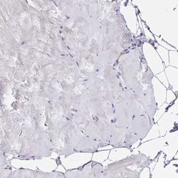 Invitrogen AP2 gamma Polyclonal Antibody 100 &mu;L; Unconjugated:Antibodies,