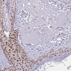 Invitrogen AP2 gamma Polyclonal Antibody 100 &mu;L; Unconjugated:Antibodies,