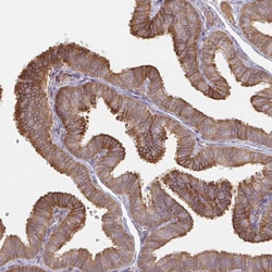 Invitrogen GRF-1 Polyclonal Antibody 100 &mu;L; Unconjugated:Antibodies,