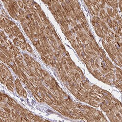 Invitrogen GRF-1 Polyclonal Antibody 100 &mu;L; Unconjugated:Antibodies,