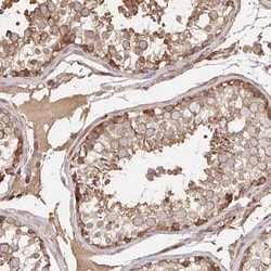 Invitrogen GRF-1 Polyclonal Antibody 100 &mu;L; Unconjugated:Antibodies,
