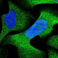 Invitrogen PSMA4 Polyclonal Antibody 100 &mu;L; Unconjugated:Antibodies,