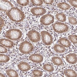 Invitrogen PSMA4 Polyclonal Antibody 100 &mu;L; Unconjugated:Antibodies,