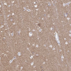 Invitrogen PACSIN1 Polyclonal Antibody 100 &mu;L; Unconjugated:Antibodies,