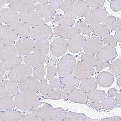 Invitrogen PACSIN1 Polyclonal Antibody 100 &mu;L; Unconjugated:Antibodies,