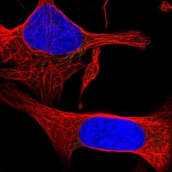 Invitrogen PPAP2C Polyclonal Antibody 100 &mu;L; Unconjugated:Antibodies,