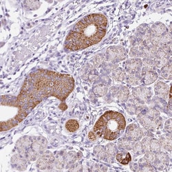 Invitrogen PPAP2C Polyclonal Antibody 100 &mu;L; Unconjugated:Antibodies,