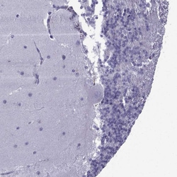 Invitrogen TRIM46 Polyclonal Antibody 100 &mu;L; Unconjugated:Antibodies,