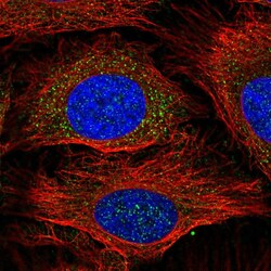 Invitrogen GSTM1 Polyclonal Antibody 100 &mu;L; Unconjugated:Antibodies,