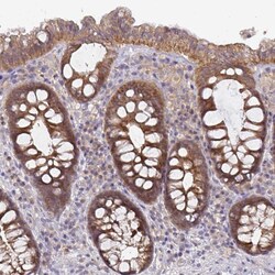 Invitrogen GSTM1 Polyclonal Antibody 100 &mu;L; Unconjugated:Antibodies,
