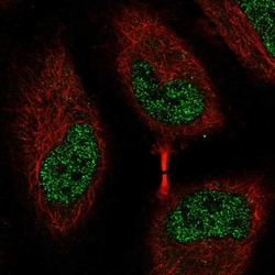 Invitrogen EEF2K Polyclonal Antibody 100 &mu;L; Unconjugated:Antibodies,