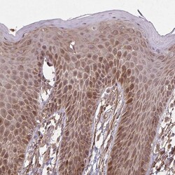 Invitrogen ZNF219 Polyclonal Antibody 100 &mu;L; Unconjugated:Antibodies,