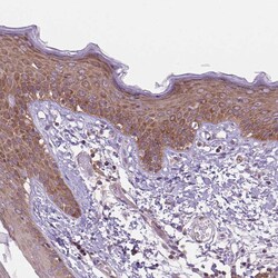 Invitrogen MINK1 Polyclonal Antibody 100 &mu;L; Unconjugated:Antibodies,