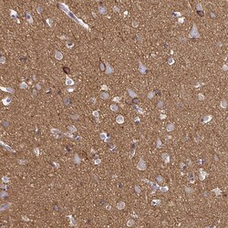 Invitrogen ATP1A3 Polyclonal Antibody 100 &mu;L; Unconjugated:Antibodies,