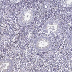 Invitrogen ATP1A3 Polyclonal Antibody 100 &mu;L; Unconjugated:Antibodies,