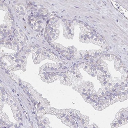 Invitrogen ATP1A3 Polyclonal Antibody 100 &mu;L; Unconjugated:Antibodies,