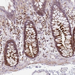 Invitrogen GRF-1 Polyclonal Antibody 100 &mu;L; Unconjugated:Antibodies,