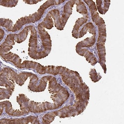 Invitrogen GRF-1 Polyclonal Antibody 100 &mu;L; Unconjugated:Antibodies,