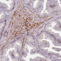 Invitrogen GRF-1 Polyclonal Antibody 100 &mu;L; Unconjugated:Antibodies,
