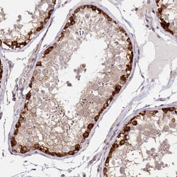 Invitrogen GRF-1 Polyclonal Antibody 100 &mu;L; Unconjugated:Antibodies,
