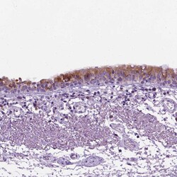Invitrogen DNAH11 Polyclonal Antibody 100 &mu;L; Unconjugated:Antibodies,