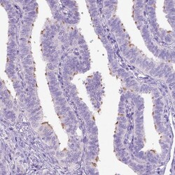 Invitrogen DNAH11 Polyclonal Antibody 100 &mu;L; Unconjugated:Antibodies,
