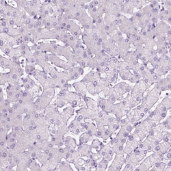 Invitrogen DNAH11 Polyclonal Antibody 100 &mu;L; Unconjugated:Antibodies,