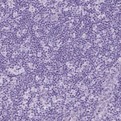 Invitrogen DNAH11 Polyclonal Antibody 100 &mu;L; Unconjugated:Antibodies,