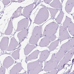 Invitrogen DNAH11 Polyclonal Antibody 100 &mu;L; Unconjugated:Antibodies,