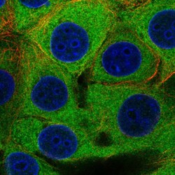 Invitrogen PFKP Polyclonal Antibody 100 &mu;L; Unconjugated:Antibodies,