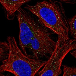 Invitrogen CK1 gamma-2 Polyclonal Antibody 100 &mu;L; Unconjugated:Antibodies,