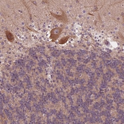 Invitrogen CK1 gamma-2 Polyclonal Antibody 100 &mu;L; Unconjugated:Antibodies,