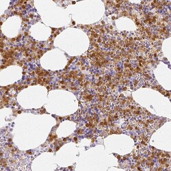 Invitrogen HK3 Polyclonal Antibody 100 &mu;L; Unconjugated:Antibodies,