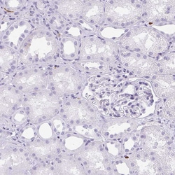 Invitrogen HK3 Polyclonal Antibody 100 &mu;L; Unconjugated:Antibodies,