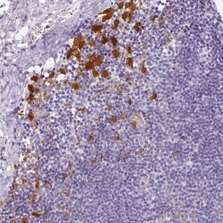 Invitrogen HK3 Polyclonal Antibody 100 &mu;L; Unconjugated:Antibodies,