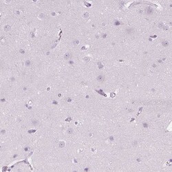 Invitrogen SFTPD Polyclonal Antibody 100 &mu;L | Buy Online | Invitrogen&trade; | Fisher Scientific