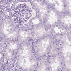 Invitrogen SFTPD Polyclonal Antibody 100 &mu;L | Buy Online | Invitrogen&trade; | Fisher Scientific