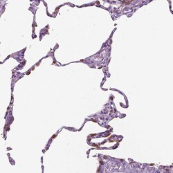 Invitrogen SFTPD Polyclonal Antibody 100 &mu;L | Buy Online | Invitrogen&trade; | Fisher Scientific