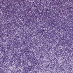 Invitrogen SFTPD Polyclonal Antibody 100 &mu;L | Buy Online | Invitrogen&trade; | Fisher Scientific