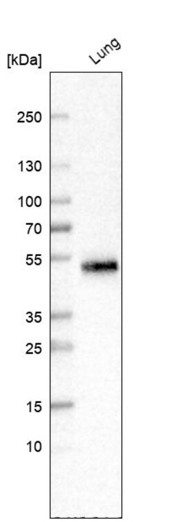 Invitrogen SFTPD Polyclonal Antibody 100 &mu;L | Buy Online | Invitrogen&trade; | Fisher Scientific