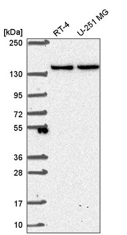 Invitrogen SH3TC1 Polyclonal Antibody 100 &mu;L; Unconjugated:Antibodies,