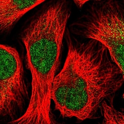 Invitrogen STK33 Polyclonal Antibody 100 &mu;L; Unconjugated:Antibodies,