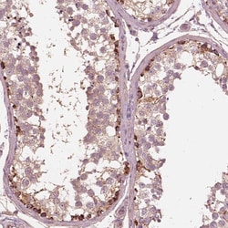 Invitrogen STK33 Polyclonal Antibody 100 &mu;L; Unconjugated:Antibodies,