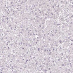 Invitrogen Desmoglein 3 Polyclonal Antibody 100 &mu;L; Unconjugated:Antibodies,
