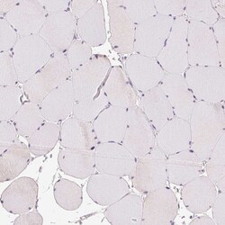 Invitrogen Desmoglein 3 Polyclonal Antibody 100 &mu;L; Unconjugated:Antibodies,