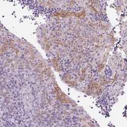 Invitrogen Desmoglein 3 Polyclonal Antibody 100 &mu;L; Unconjugated:Antibodies,