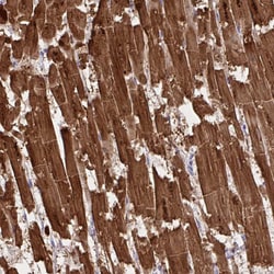 Invitrogen Cardiac Troponin C Polyclonal Antibody 100 &mu;L; Unconjugated:Antibodies,