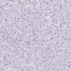 Invitrogen Cardiac Troponin C Polyclonal Antibody 100 &mu;L; Unconjugated:Antibodies,