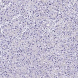 Invitrogen Cardiac Troponin C Polyclonal Antibody 100 &mu;L; Unconjugated:Antibodies,